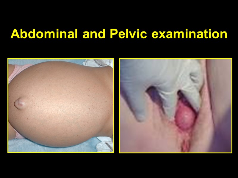 Abdominal and Pelvic examination